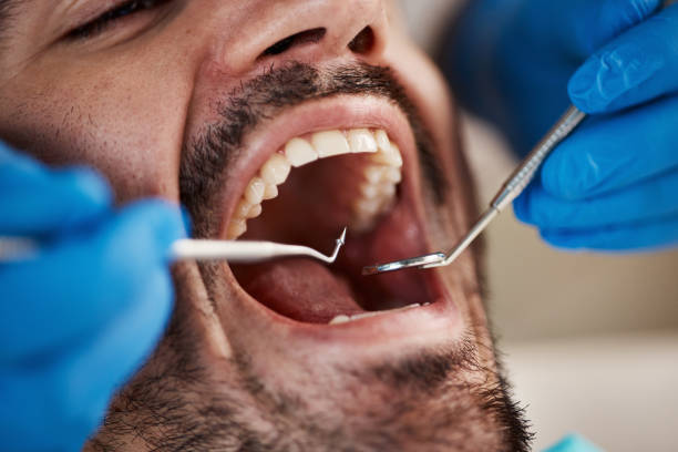 Best Root Canal Emergency Dentist  in Barrington, IL