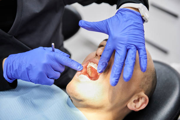 Best Chipped Tooth Repair Near Me  in Barrington, IL